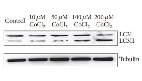 Western blot, C2C12 cells, MAP1LC3B antibody (A7198), 1:10000 dilution, IHC Validated